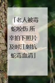 老人被毒蛇咬伤 所幸拍下照片及时注射抗蛇毒血清